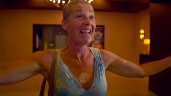 Unveiling Transformation: The Inspiring Journey of Simone